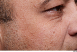 Eye Face Cheek Hair Skin Man Chubby Wrinkles Studio photo references